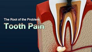 علل دندان درد شدید و نحوه تسکین درد