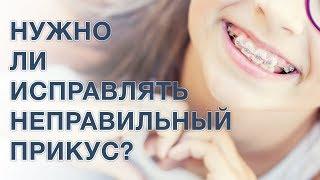 Неправильный прикус. Нужно ли исправлять прикус?