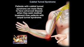 Cubital Tunnel Syndrome - Everything You Need To Know - Dr. Nabil Ebraheim