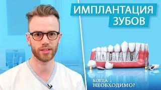 Нужно ли устанавливать зубной имплант?