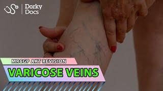 Varicose Veins 05 07 2023