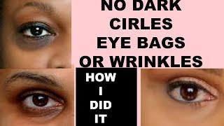 3 Steps To Get Rid Of Dark Circles, Eye Bags, Puffy Eyes, Wrinkles And Crows Feet
