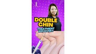 Double Chin Treatment Options and Recovery Explained - Dr. Renee | RJ Clinic