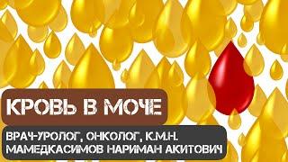 Кровь в моче! Что делать? Врач-уролог, онколог, к.м.н. Мамедкасимов Нариман Акитович