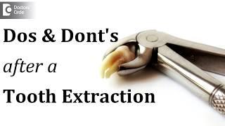 Dos and Dont's after a tooth extraction - Dr. Sathyadeep. V