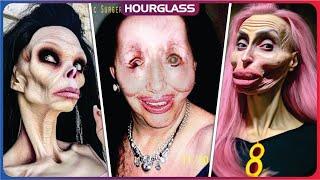 30 Celebrity Plastic Surgery Disasters | You’d Never Recognize Today