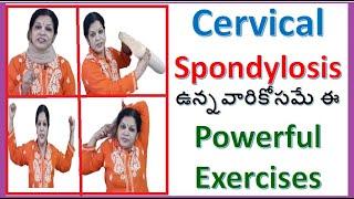 Yoga/ Exercises For Cervical Spondylosis