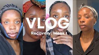 VLOG #13: Week 1 After Double Jaw Surgery - Nasal Congestion, Sleepless Nights & Balloon Swelling!