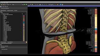 Automatic whole-body CT segmentation in 2 minutes using 3D Slicer and TotalSegmentator