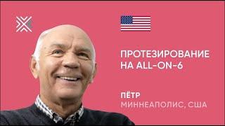 Из США в Беларусь на имплантацию зубов All-On-6