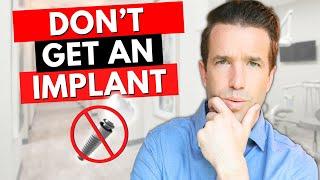 5 Reasons NOT get a Dental Implant