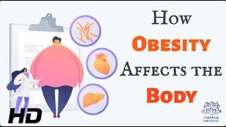 The Heavy Burden of Obesity: Understanding its Effects on Your Body