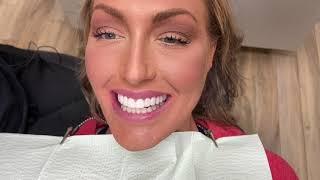 Houston Cosmetic Dentist....Want a Hollywood Smile without breaking the bank?? Watch this!