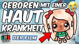  MEINE BESONDERE HAUT  KINO FILM EXTRA LANG  mit HAPPY END  TOCA BOCA TRAURIGE MOBBING STORY