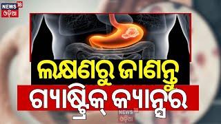 ଲକ୍ଷଣରୁ ଜାଣନ୍ତୁ ଗ୍ୟାଷ୍ଟ୍ରିକ୍‌ କ୍ୟାନ୍ସର |Symptoms & Treatment For Gastric Cancer |My Doctor|Odia News