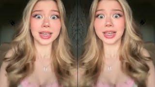 TIKTOK TEEN BRACES QUEENS (64)