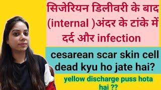 सी सेक्शन के बाद इंटरनल इन्फेक्शन | cesarean k baad internal stitches ki care| Tanke kyu pakk jate h