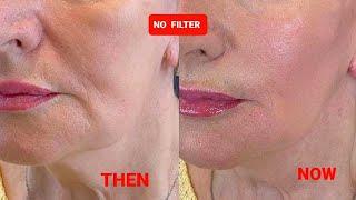 AMAZING LIFTING Massage | Sagging jowls | Nasolabial folds | Marionette lines | Double chin