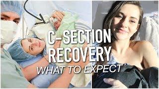 WHAT TO EXPECT AFTER A C-SECTION || POSTPARTUM PAIN, BLEEDING AND NURSING || BETHANY FONTAINE