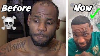 LEBRON JAMES' HAIRLINE HAS BEEN RESTORED!