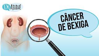 Câncer de Bexiga: quando suspeitar? Sintomas, fatores de risco, diagnóstico e tratamento!