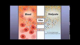 Hemodialysis Hemofilter and countercurrent animation