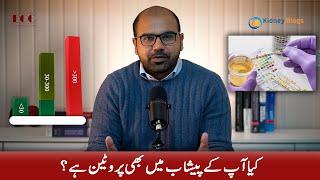 Proteins in the urine | Dr. Awais Zaka, MD | Nephrologist | Kidney disease | Episode 05
