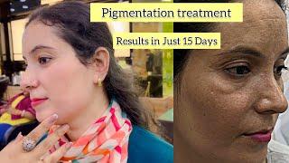 Pigmentation treatment ka Results Dekh के Client Hua Khush  @NISHA_LAMBHA