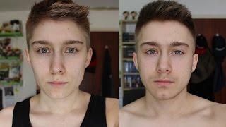 1 YEAR ON T: FTM TRANSGENDER