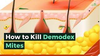 How to Kill Demodex Mites