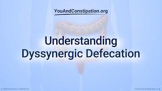 Understanding Dyssynergic Defecation