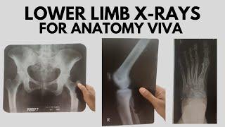 Lower Limb Radiological Anatomy | X-Rays of Hip, Knee Ankle, Foot | For Anatomy Viva