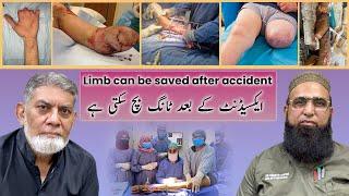 Limb can be saved after accident: a public service message : (Prof Dr Javed Iqbal )