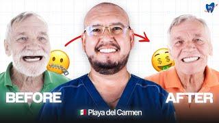 Smile Makeover Review in Playa del Carmen: How a US Patient Got His Dream Smile in Mexico!