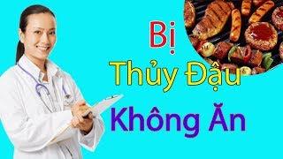 [ Bạn Cần Biết ] Thực Phẩm Không Nên Ăn | Khi Bị Thuỷ Đậu