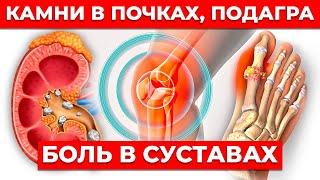 Мочевая кислота — страшная ОПАСНОСТЬ! Диета для выведения мочевой кислоты