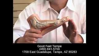 Good Feet Tempe Do Arch Supports Work? Foot Pain Heel Back Hip Knee Pain Plantar Fasciitis