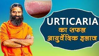 Ayurvedic Treatment Of Urticaria (शीतपित्त) | Swami Ramdev