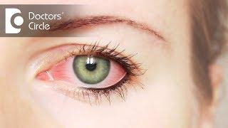 What can cause foreign body sensation in one eye? - Dr. Elankumaran P