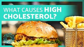 What Causes High Cholesterol?  5 Major Causes & Health Risks