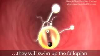 Follicle Development and Ovulation I Educational Video I Planet WOMEN IVF Centre I Dr.Mehul Damani