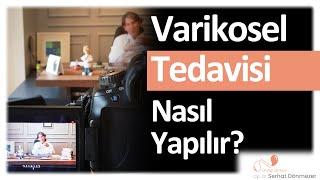 Varikosel Tedavisi Nasıl Yapılır? | Op. Dr. Serhat Dönmezer - Üroloji Uzmanı