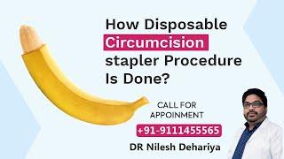 How Disposable circumcision stapler Procedure is Done?