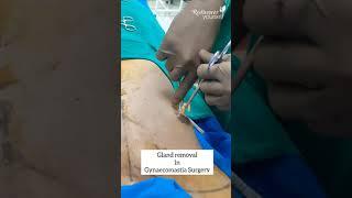 Gynaecomastia Surgery in Pune by Best Cosmetic Surgeon