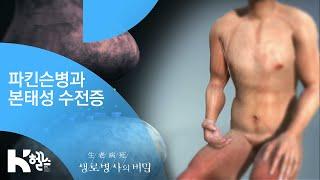 파킨슨병과 본태성 수전증 - (20190116_679회 방송) 몸이 보내는 경고, 떨림