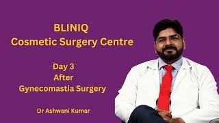 Patient Experience after 3rd day of Gynecomastia Surgery