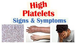 High Platelets (Thrombocytosis) Signs & Symptoms | Rapid Review