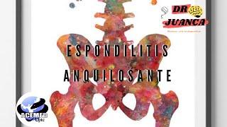 Espondilitis Anquilosante ACEMED UPTC