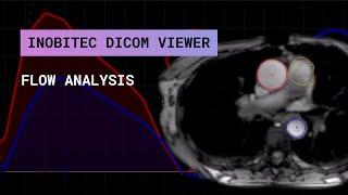 The Flow Analysis with Inobitec DICOM Viewer Pro