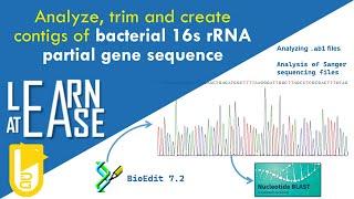 How to correctly analyze raw sequence files of bacterial 16s rRNA partial gene sequence